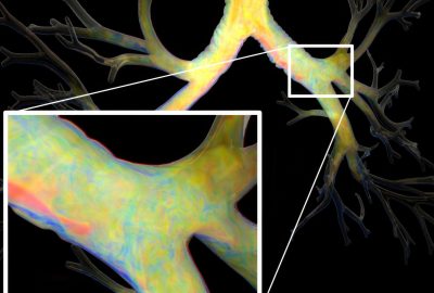 2016 SA Technical Papers_Liu_A scalable Schur-complement fluids solver for heterogeneous compute platforms