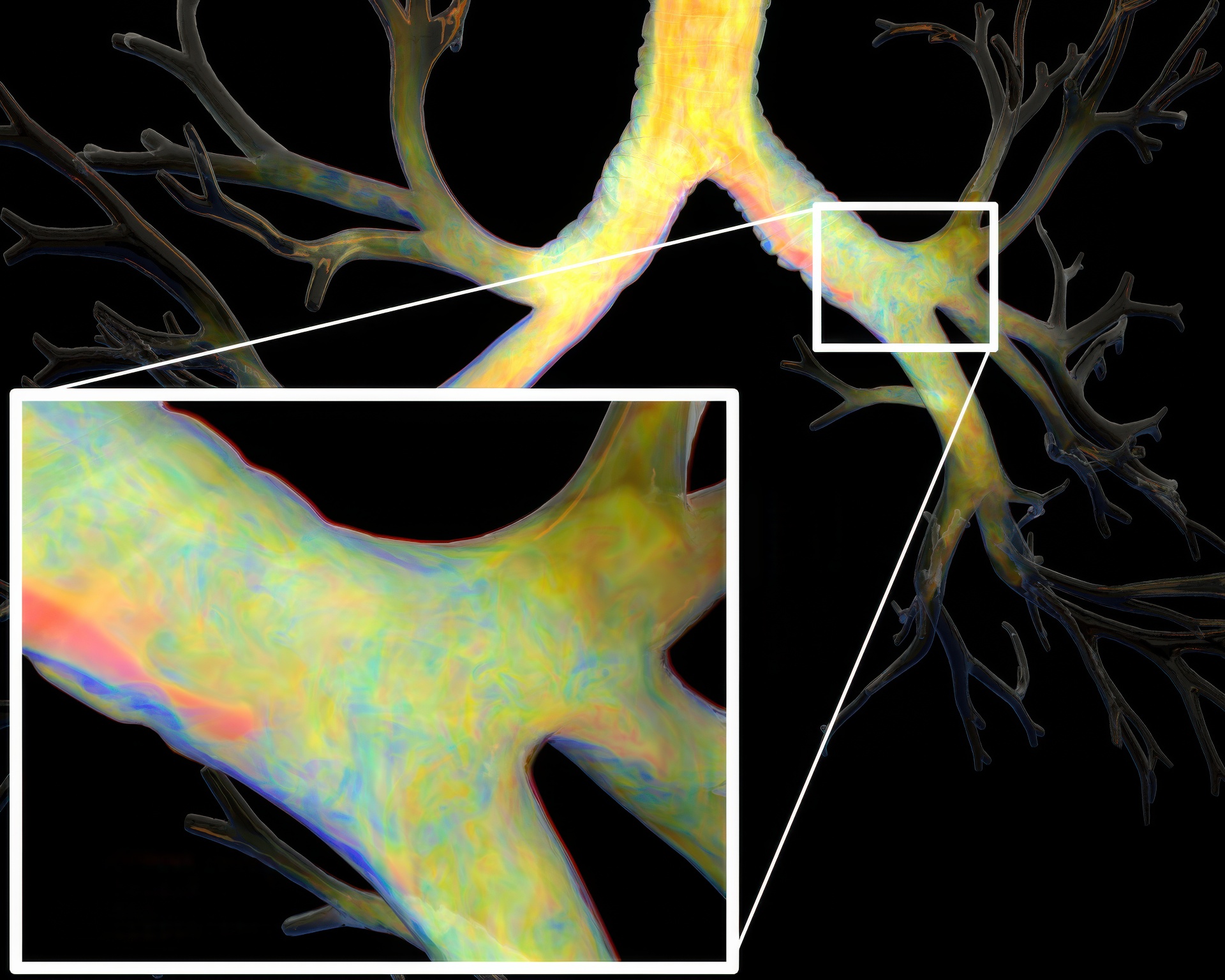 2016 SA Technical Papers_Liu_A scalable Schur-complement fluids solver for heterogeneous compute platforms