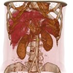 2016 SA Technical Papers_Torres_High-Resolution Interaction with Corotational Coarsening Models