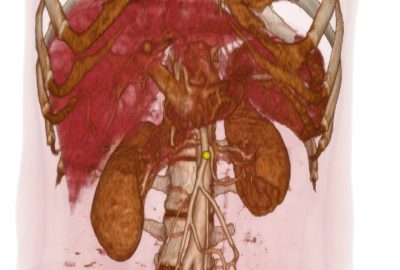 2016 SA Technical Papers_Torres_High-Resolution Interaction with Corotational Coarsening Models