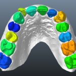 2016 SA Technical Papers_Wu_Model-Based Teeth Reconstruction
