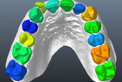 2016 SA Technical Papers_Wu_Model-Based Teeth Reconstruction