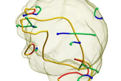 2017 SA Technical Papers_Palacios_Tensor Field Design in Volumes