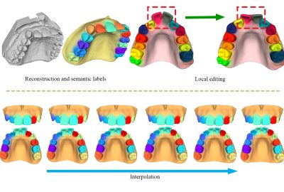 2022 SA Technical Papers_Zhang_An Implicit Parametric Morphable Dental Model